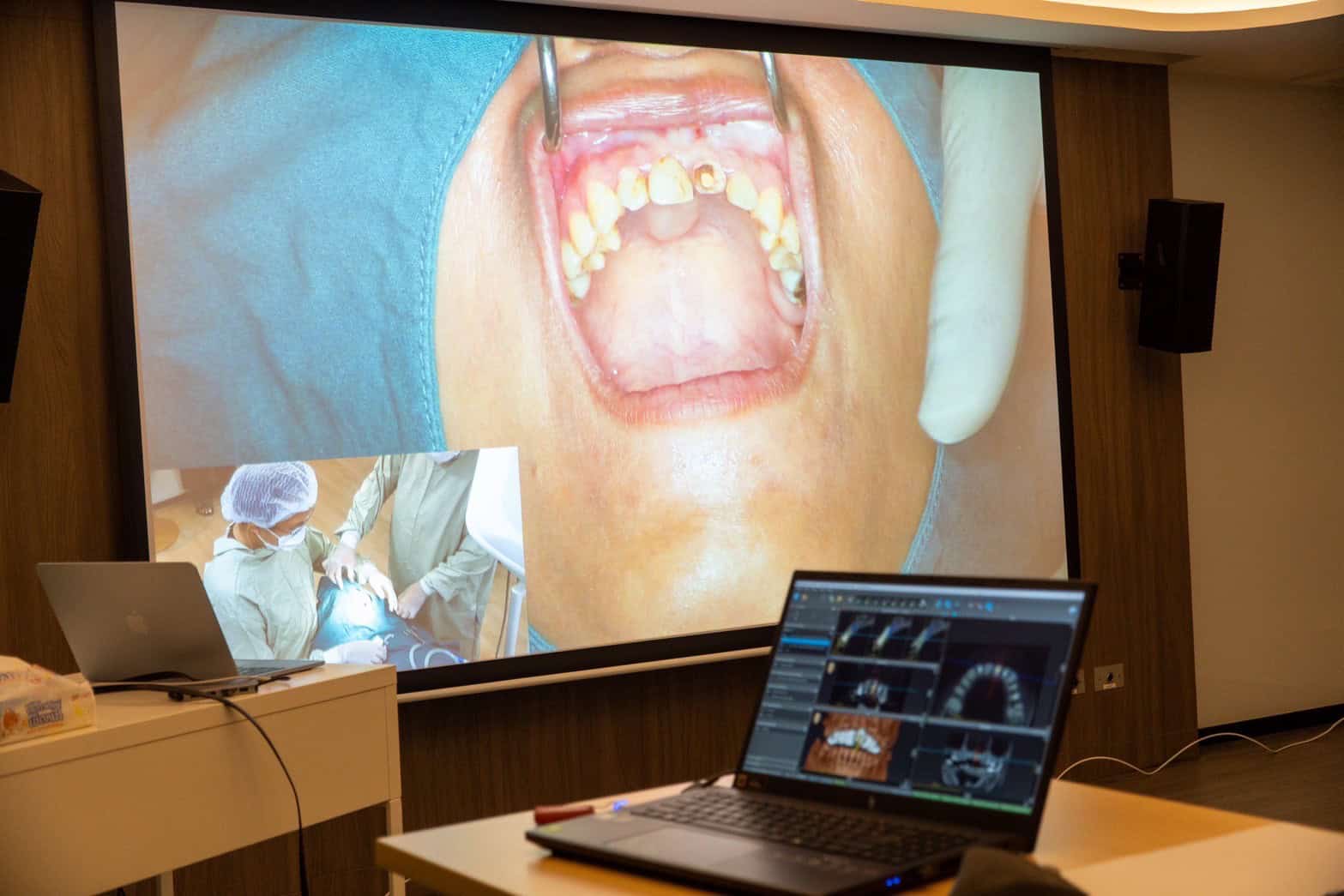 ภาพบรรยากาศจากหลักสูตรอบรม“Guided Immediacy: Esthetic Zone and Posterior!” 43 LINE ALBUM 22668 250622 17